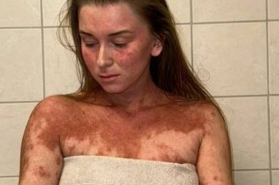 Frida tok dramatisk valg: – Har vondt døgnet rundt