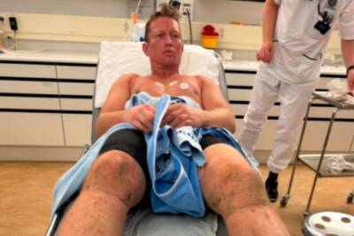 Syklet 700 kilometer: – Sjekkes for Rabdomyolyse