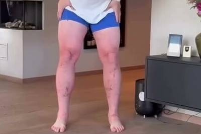 Deler nye sjokkbilder: - Det er helt vilt!