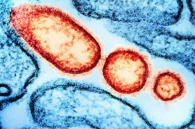 FHI: - Unngå kontakt