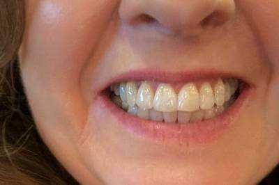 Kari må betale vill sum