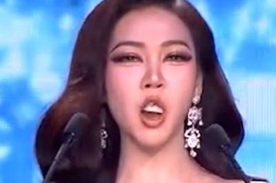 Tannglipp på direkten