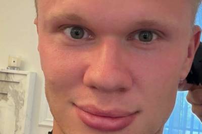 Håret er borte!