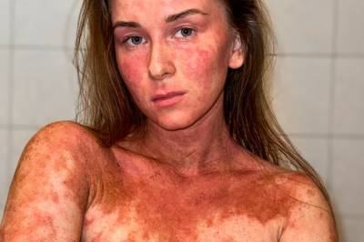 Frida Karoline (29) fortviler: - Helt umenneskelig