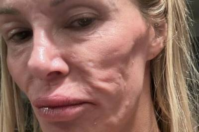 Har omsider fått svar