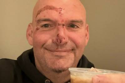 Røper skrekkhendelse: - 20 sting