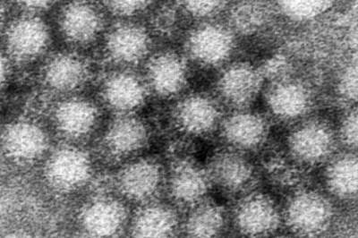 Øker i Norge: - Ingen oversikt