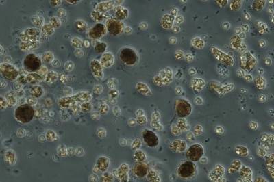 Giftig alge i Oslofjorden: – Kjempestor oppblomstring