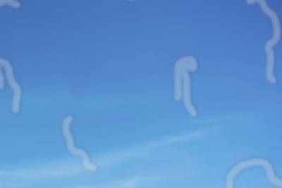 Ser du prikker eller tråder som beveger seg i synsfeltet? Det er ikke uvanlig