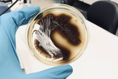 Bakterier der maten produseres kan overleve vask og desinfeksjon