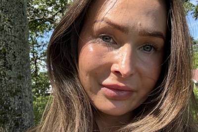 Johanne (33) rammet av sjelden sykdom: Botox ble redningen