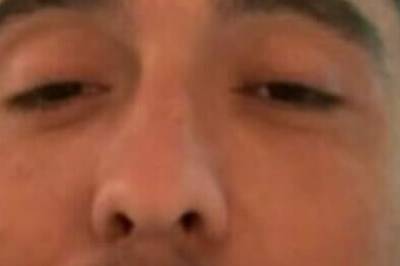 Skrekkbilder: – Intense smerter