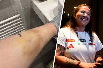 Truffet av slegge: Fryktet for karrieren