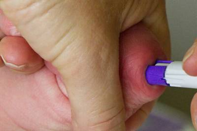 Blodprøvar på spesialpapir sparar tid