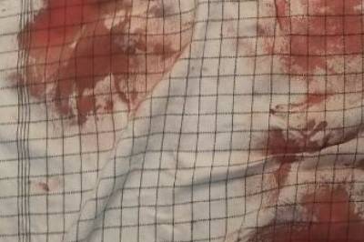 Kevin (35) angrepet: Politiet med beslag