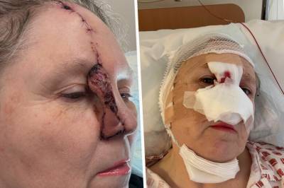 Det startet med et lite sår: – Trodde ikke det var sant