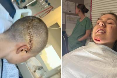 Viser frem skrekkbilder