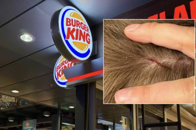 Ut mot Burger King: – Veldig uforsvarlig