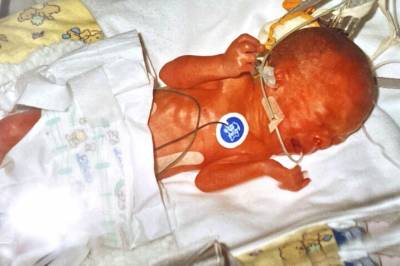 Veide bare 670 gram