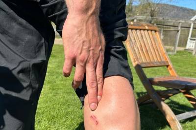 Blodig alvor for Noreg sitt EM-håp: Angrepet av hund på trening i USA