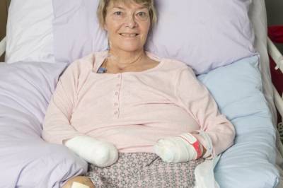 Våknet opp uten hender