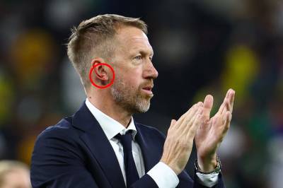 Blodig Potter: – Noen beit meg