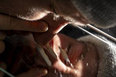 Advarer unge: – Den ene gangen er nok til å havne på sykehjem