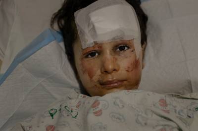 Zahraa (7) lå og sov da Israel angrep.