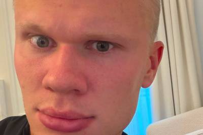 Hårklippen gikk viralt. Pengene renner inn.