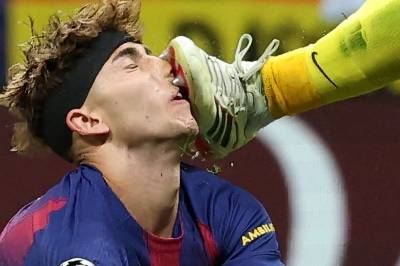 Flere stygge skader i Mesterligaen: Her blir han stemplet i ansiktet med metall-knotter