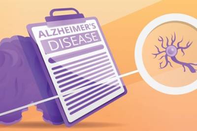 GLP-1R som en potensiell kobling mellom diabetes og Alzheimers sykdom