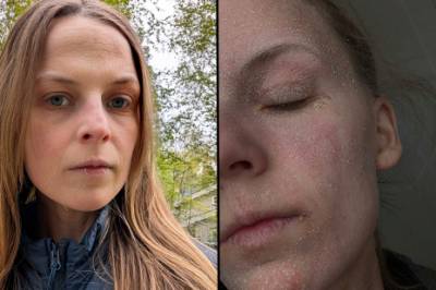 TSW: - Jeg følte at kroppen min stod i brann