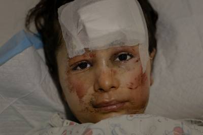 Månedens bilder: Krigens ansikt