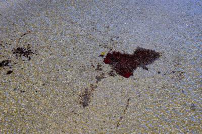 Etterforskes som drapsforsøk