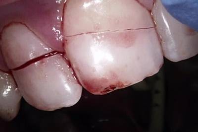 Tennene knust i ulykke: Kommunen tok ikke telefonen