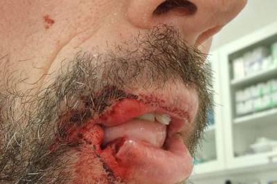 Bilist slo syklist. Nå er dommen klar.