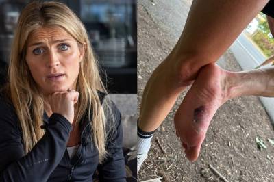 Skaden kunne stoppet Johaugs løpedrøm: – Blodet sprutet i hele sommer