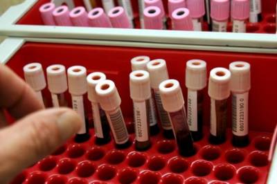 Et nytt høysensitivt kardialt troponin
